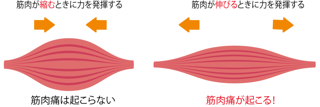 筋肉痛が起こる仕組み