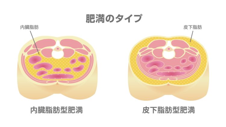 内臓脂肪の画像